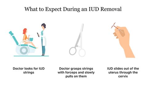 What To Expect During An Iud Insertion