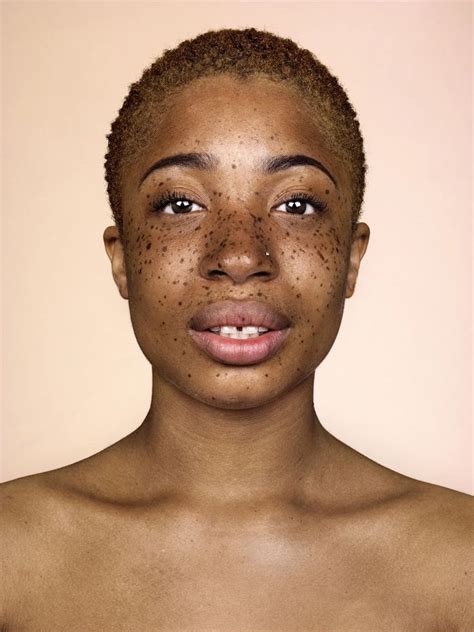 Freckles Brock Elbank S Striking Portraits In Pictures People With