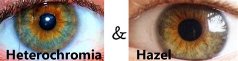 Heterochromia Iridum People With Two Different Colored Eyes Owlcation