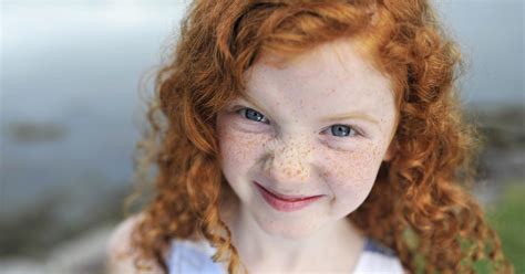 Babies commonly develop rashes on their faces. Are redheads with blue eyes really going extinct ...