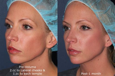 Skin Problems For 20 Year Olds San Diego Cosmetic Laser Dermatology