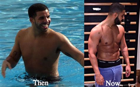 Drake Plastic Surgery Before And After Photos