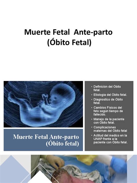 Obito Fetal Pdf El Embarazo Parto