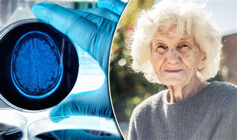 Alzheimers Disease Or Ageing Spotting Early Symptoms Of Dementia Health Life And Style