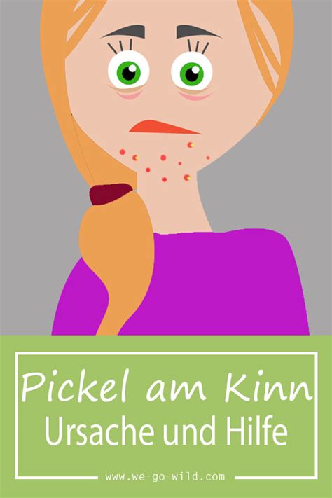 21, 1995 and was raised alongside her brother in poydras, louisiana.while fans have simply come to know her as pickle, her real name is actually cheyenne wheat. Pickel am Kinn loswerden - Das hilft wirklich gegen Pustel