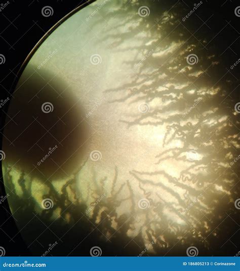 Vista Microscópica De Una Colonia De Hongos Aureobasidium Pullulans