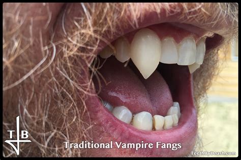 Traditional Vampire Teeth By Dnash
