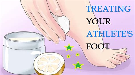 How To Treat And Prevent Athletes Foot Treating Your Athletes Foot Youtube