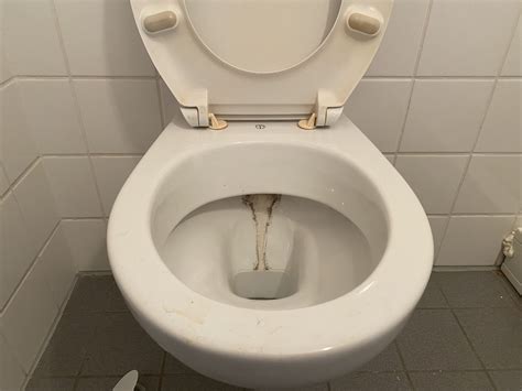 Kalk In Der Toilette Reinigen Hausmittel Gegen Kalk Und Urinstein