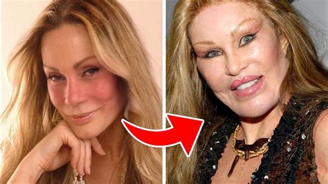 Cosmetic Surgeries That Went Terribly Wrong Youtube