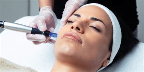 All About Microneedling With Exosomes Columbia Skin Clinic