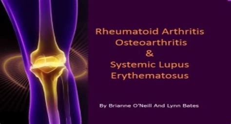 Free Download Introduction Rheumatoid Arthritis Powerpoint Presentation