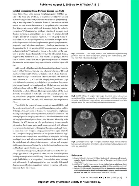 Isolated Intracranial Rosai Dorfman Disease In A Child American
