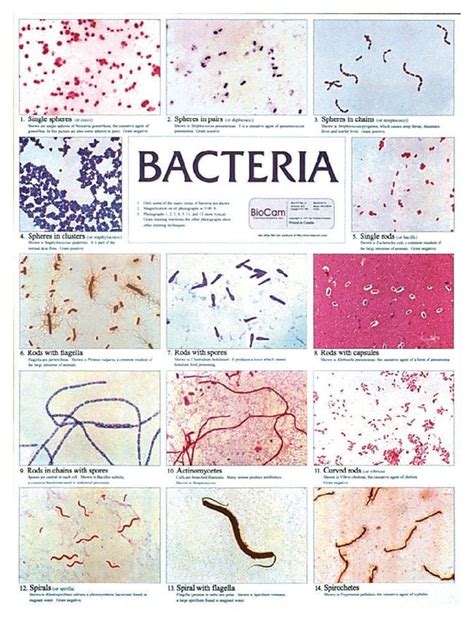 microbiology bacteria chart
