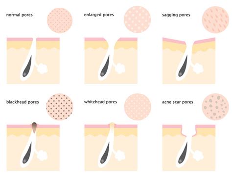 How To Shrink Pores A Complete Step By Step Guide The Yesstylist