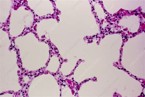 Lm Of A Cross Section Through Alveoli In The Lung Stock Image P590