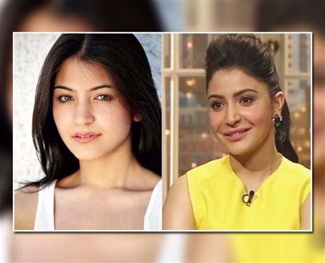Before And After Pictures Of Bollywood Actresses Who Opted For Plastic Surgery Herzindagi