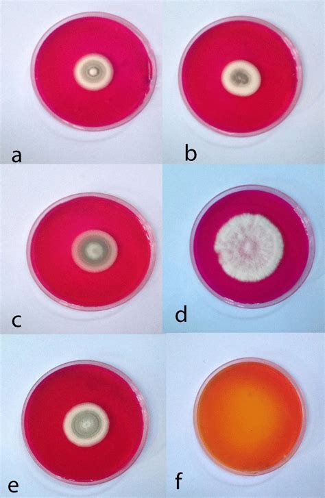 Production Of L Asparaginase By Yemeni Filamentous Fungi