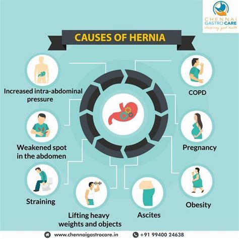 Hiatal Hernia Symptoms Causes Risk Factors Diagnosis The Id Doc