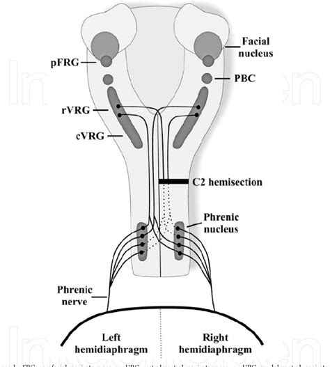 Figure 1 From Phrenic Nerve Pacing Current Concepts Semantic Scholar