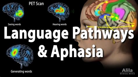 Language Pathways And Aphasia Animation Youtube