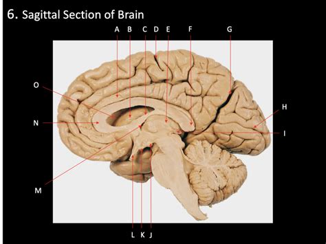 Sagittal Section Of The Brain Diagram Quizlet
