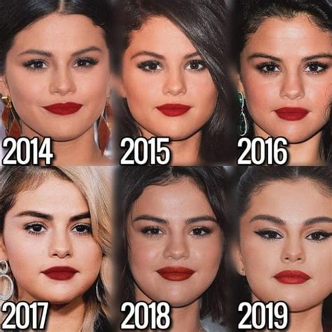 Pin By Betül On Before And After Selena Selena Gomez Pictures Selena Selena Gomez