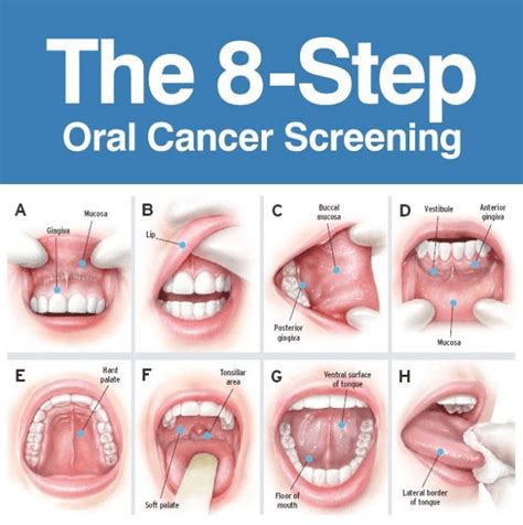 Do Dentists Check For Throat Cancer