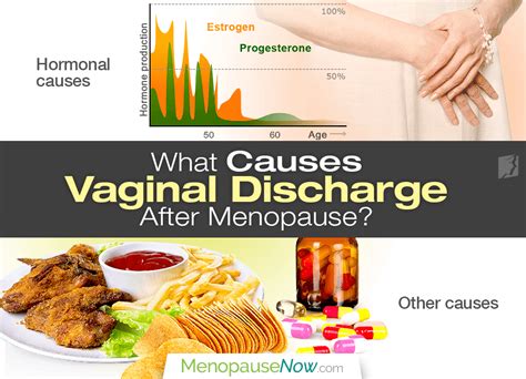 Vaginal Discharge After Menopause Menopause Now