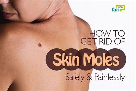 How To Get Rid Of Moles Safely And Painlessly Fab How