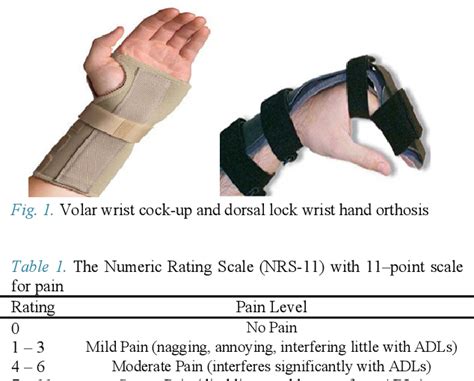 Volar Hand Splint