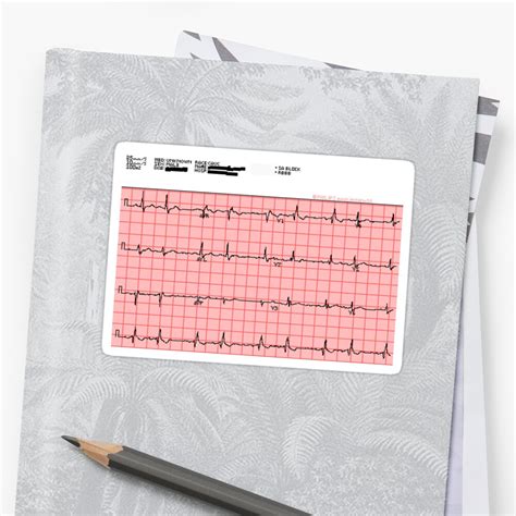 Standard 12 Lead Ecg Stickers By The Student Physiologist Redbubble