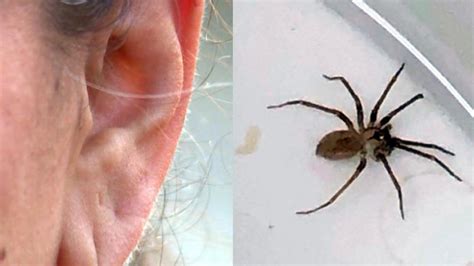 Highly Venomous Brown Recluse Spider Found In Womans Ear
