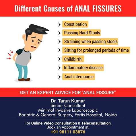 Dr Tarun Kumar Surgeon Different Causes Of Anal Fissures