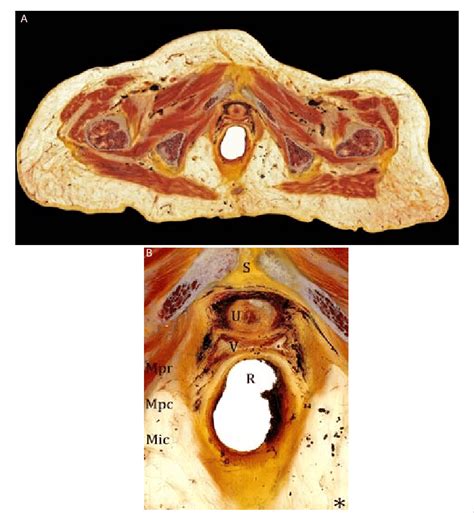 Figure La B Female Pelvis A Plastinated Transverse Section Of The