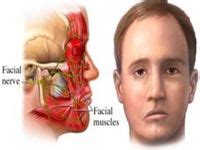 200 Best Bells Palsy Ideas Bells Palsy Facial Nerve Bells