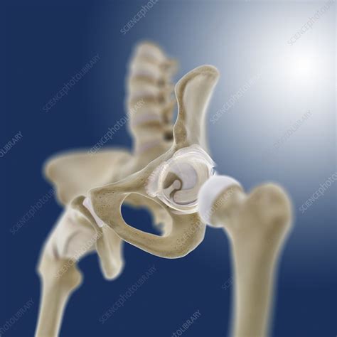 Hip Socket Anatomy Artwork Stock Image C0200133 Science Photo