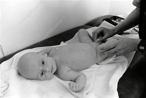 Paediatric Examination Of Babys Testicles Stock Image M8250502