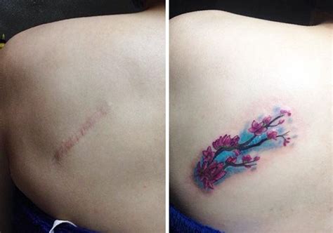Pin On Scar Reclaiming Tattoos