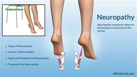 Shoes for neuropathy are designed. Top 5 Best Foot Massagers for Diabetic Peripheral ...