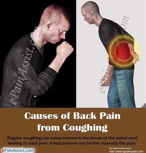 Back Pain From Coughingcausessymptomstreatmentdiagnosis