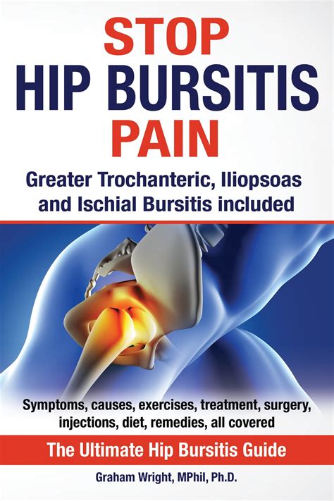 Causes Of Trochanteric Bursitis Hip Bursitis Exercise