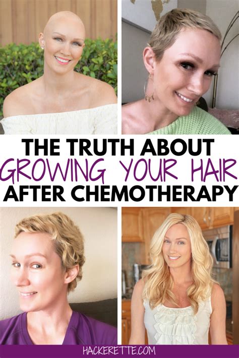 Hair Growth After Chemo Timeline With Pictures Hair Growth After