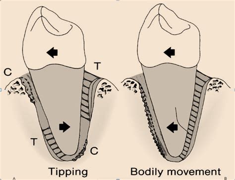 Biology Of Tooth Movements Focus Dentistry