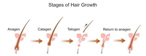 The first signs of significant hair loss or clinical balding are seen in this stage. Stress is Causing Your Hair Loss: Here's Why