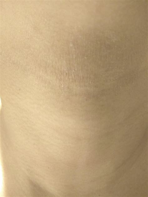 [skin concern] dry patches on my neck and face : SkincareAddiction