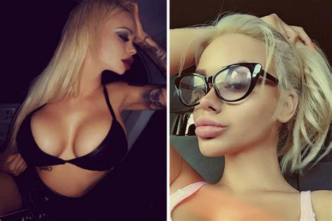 Model With Breast Implants Wins Beauty Title For The Best