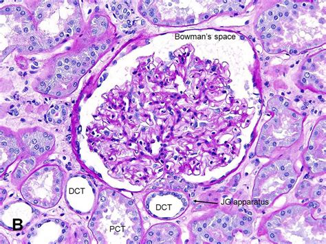 American Urological Association Kidney Renal Corpuscle Glomerulus