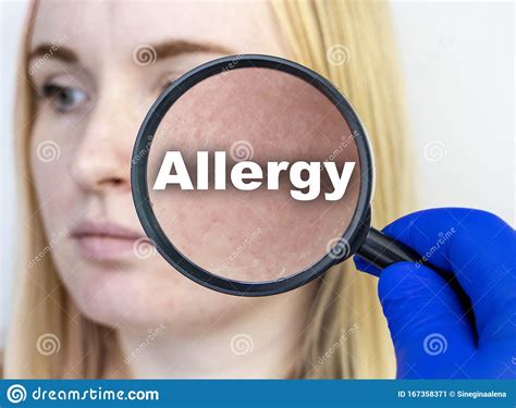Allergy And Rash Close Up A Woman Is Being Examined By A Doctor