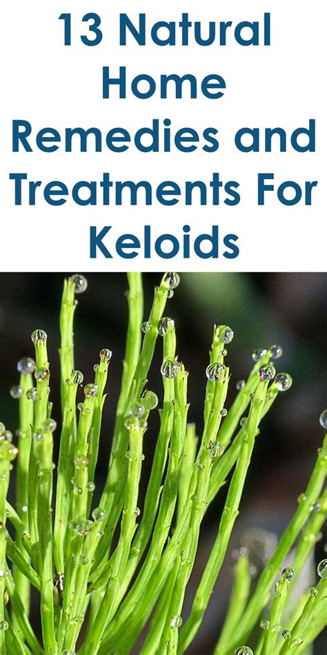 13 Quality Home Remedies For Keloids